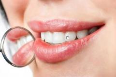 tooth-jewellery-2