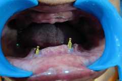 Dental-treatment-12