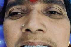 Dental-treatment-15