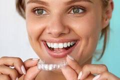 Invisible-aligners-4