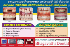 zirconia-teeth-1